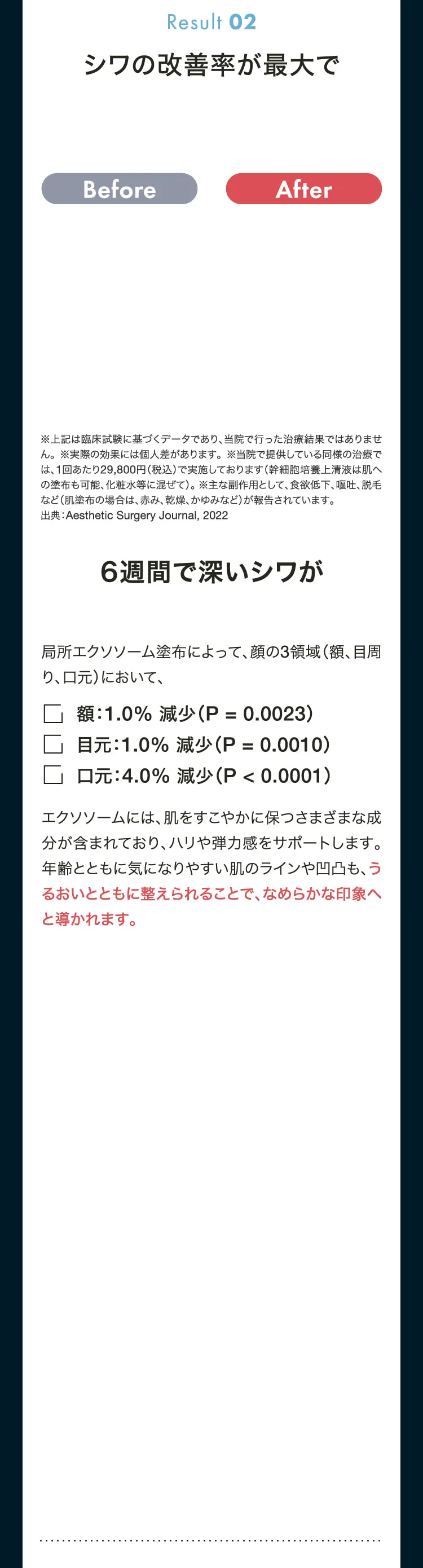 Result02　局所エクソソーム塗布によって、顔の3領域（額、目周り、口元）において、シワが額：1.0％減少、目元：1.0％減少、口元：4.0％減少　エクソソームには、肌をすこやかに保つさまざまな成分が含まれており、ハリや弾力感をサポートします。年齢とともに気になりやすい肌のラインや凹凸も、うるおいとともに整えられることで、なめらかな印象へと導かれます。