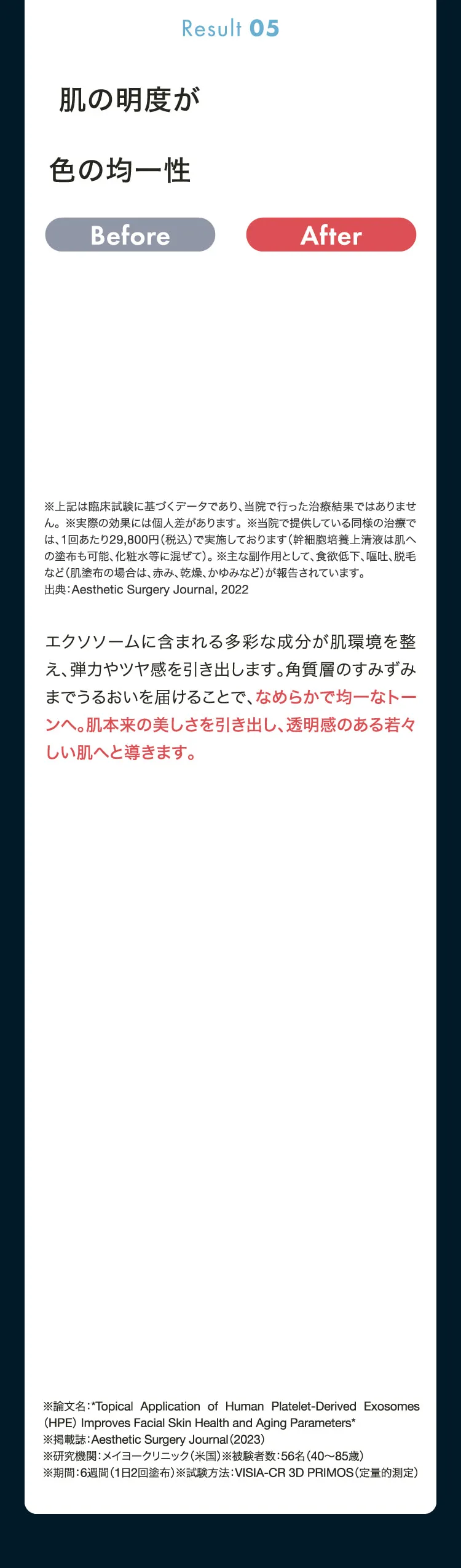 Result05　エクソソームに含まれる多彩な成分が肌環境を整え、弾力やツヤ感を引き出します。角質層のすみずみまでうるおいを届けることで、なめらかで均一なトーンへ。肌本来の美しさを引き出し、透明感のある若々しい肌へと導きます。